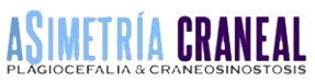 Asimetria Craneal